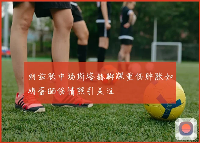利兹联中场斯塔赫脚踝重伤肿胀如鸡蛋晒伤情照引关注